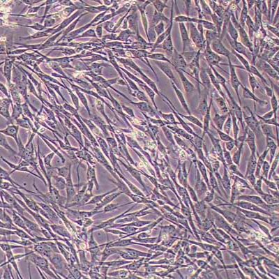 人滑膜成纤维细胞永生化(STR鉴定)丨逸漠(immocell)