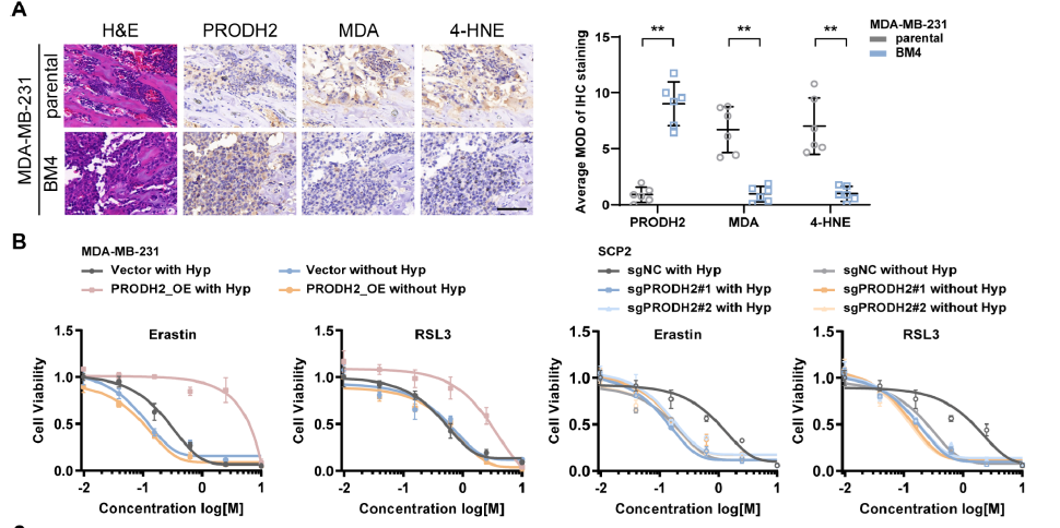 【IF 16.6】破解乳腺癌骨转移“恶性循环”!Absin代谢检测试剂盒助力PRODH2机制研究登顶科研前沿