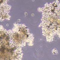 Hs-611.T人霍奇金淋巴瘤细胞(STR鉴定)丨逸漠(immocell)