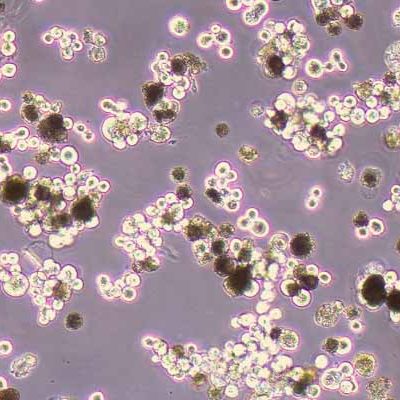 SNU-5人胃癌细胞(STR鉴定)丨逸漠(immocell)