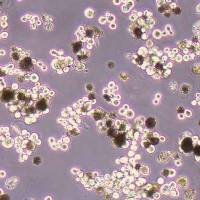 SNU-5人胃癌细胞(STR鉴定)丨逸漠(immocell)