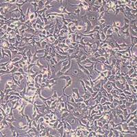 KYSE-450人食管鳞癌细胞(STR鉴定)丨逸漠(immocell)