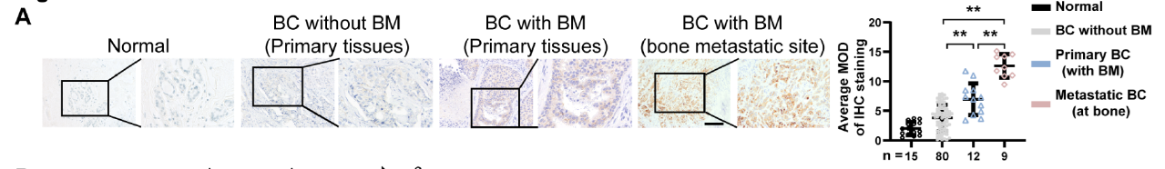 【IF 16.6】破解乳腺癌骨转移“恶性循环”!Absin代谢检测试剂盒助力PRODH2机制研究登顶科研前沿