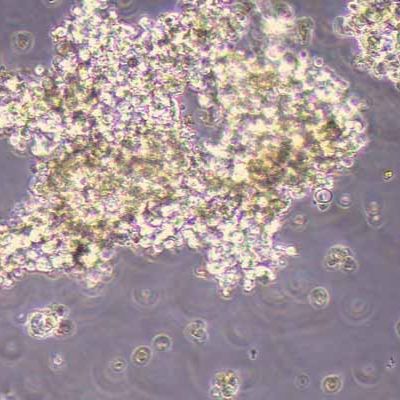 NCI-H889人小细胞肺癌细胞(STR鉴定)丨逸漠(immocell)