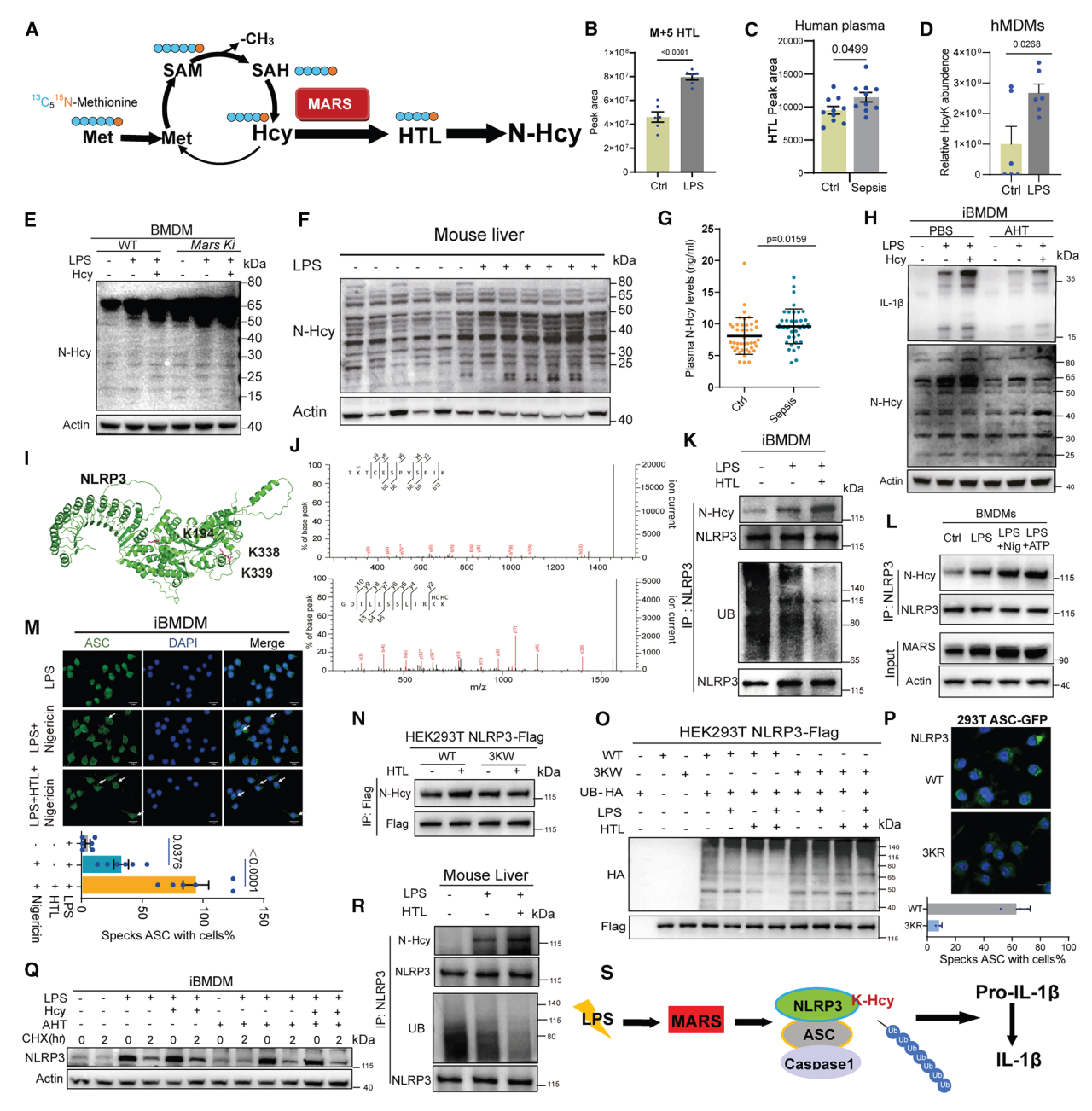 Cell Metab项目文章 | Lip-MS+转录组拿下代谢顶刊！同济大学团队发现新型抗炎代谢物——同康酸！