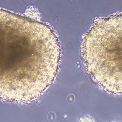 NCI-H1436人小细胞肺癌(STR鉴定)丨逸漠(immocell)