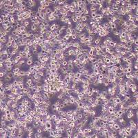 KHYG-1人NK细胞淋巴瘤细胞(STR鉴定)丨逸漠(immocell)