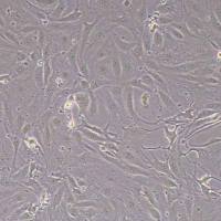 SW1710人膀胱癌细胞(STR鉴定)丨逸漠(immocell)