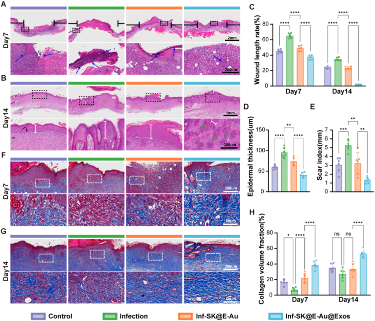 HE和Masson染色 HE和Masson染色