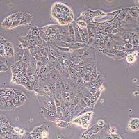 HT-1197人膀胱癌细胞(STR鉴定)丨逸漠(immocell)