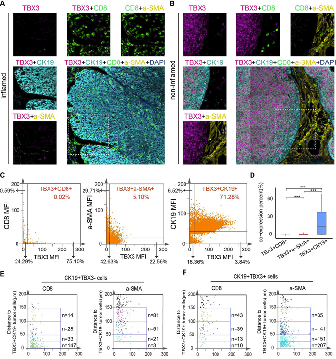 从实验室到临床| Tissue Cytometry技术助力解析膀胱癌免疫抑制机制,为靶向治疗提供方向
