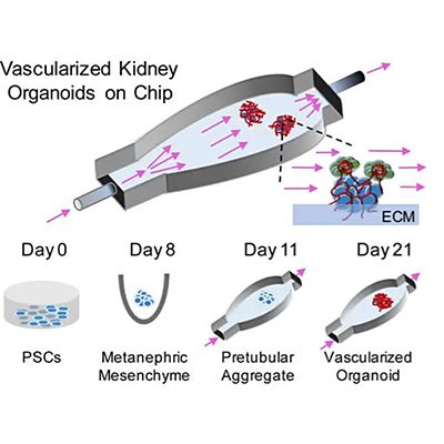 血管化肾脏类器官芯片