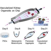血管化肾脏类器官芯片