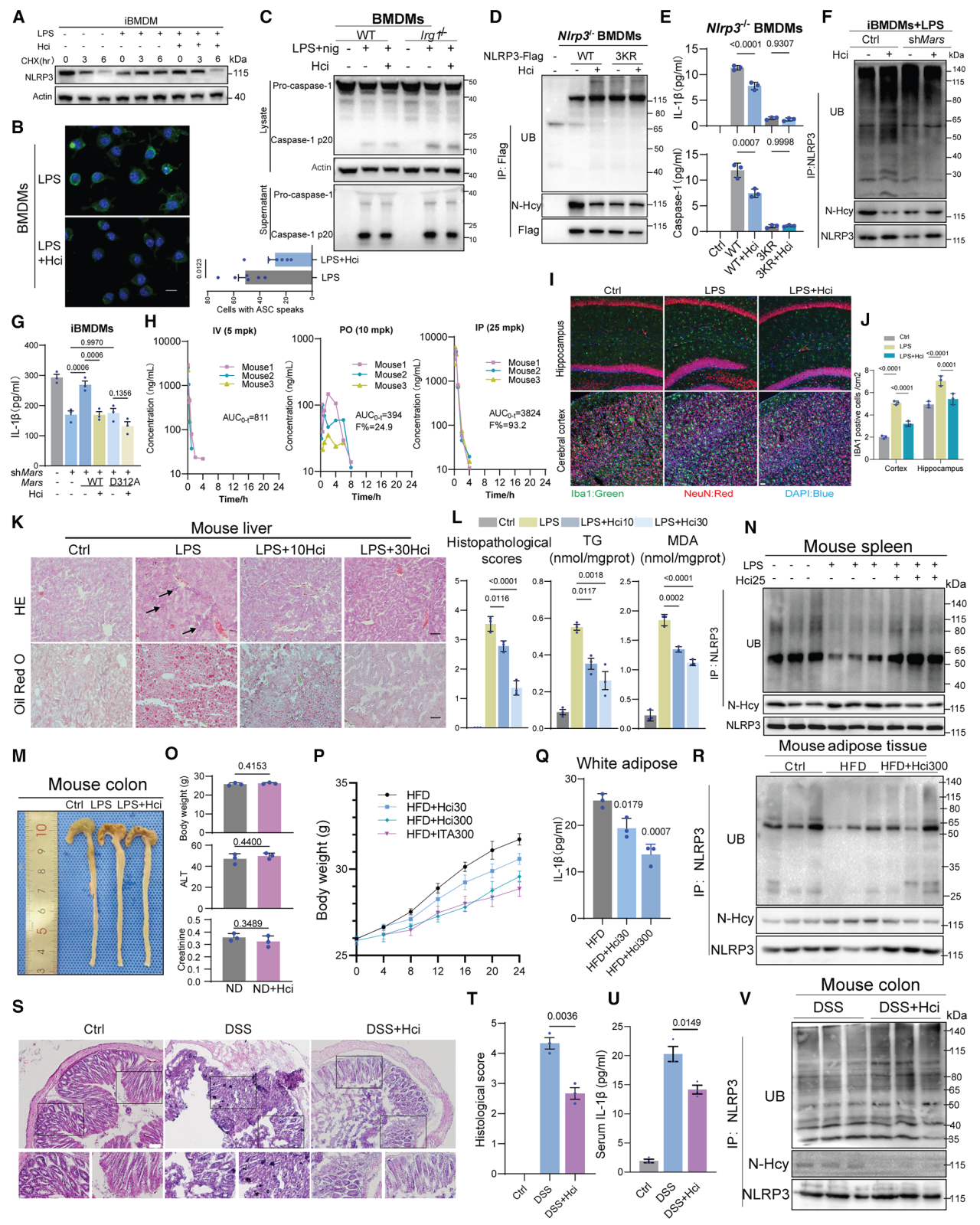 Cell Metab项目文章 | Lip-MS+转录组拿下代谢顶刊！同济大学团队发现新型抗炎代谢物——同康酸！