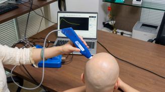 上海地区女性不同年龄和部位的头皮生物物理特性研究