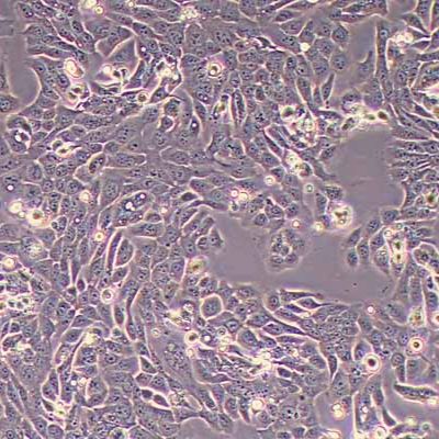 SNU-C5人结直肠腺癌细胞(STR鉴定)丨逸漠(immocell)