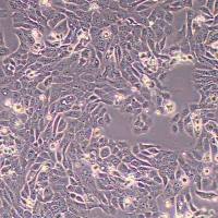 SNU-C5人结直肠腺癌细胞(STR鉴定)丨逸漠(immocell)