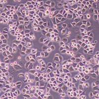 U14-FLUC-PURO小鼠子宫颈癌细胞-FLUC标记-puro抗性丨逸漠(immocell)