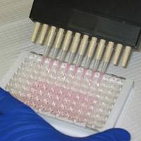 寄生肺吸虫IgG抗体检测试剂盒(酶联免疫法)