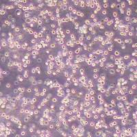 H22-NLUC-puro小鼠肝癌细胞-NLUC标记-puro抗性丨逸漠(immocell)