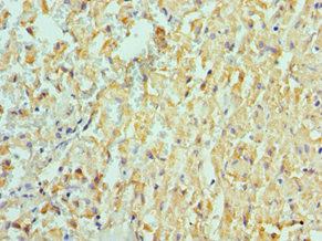 CSB-PA618774ESR1HU IHC-1