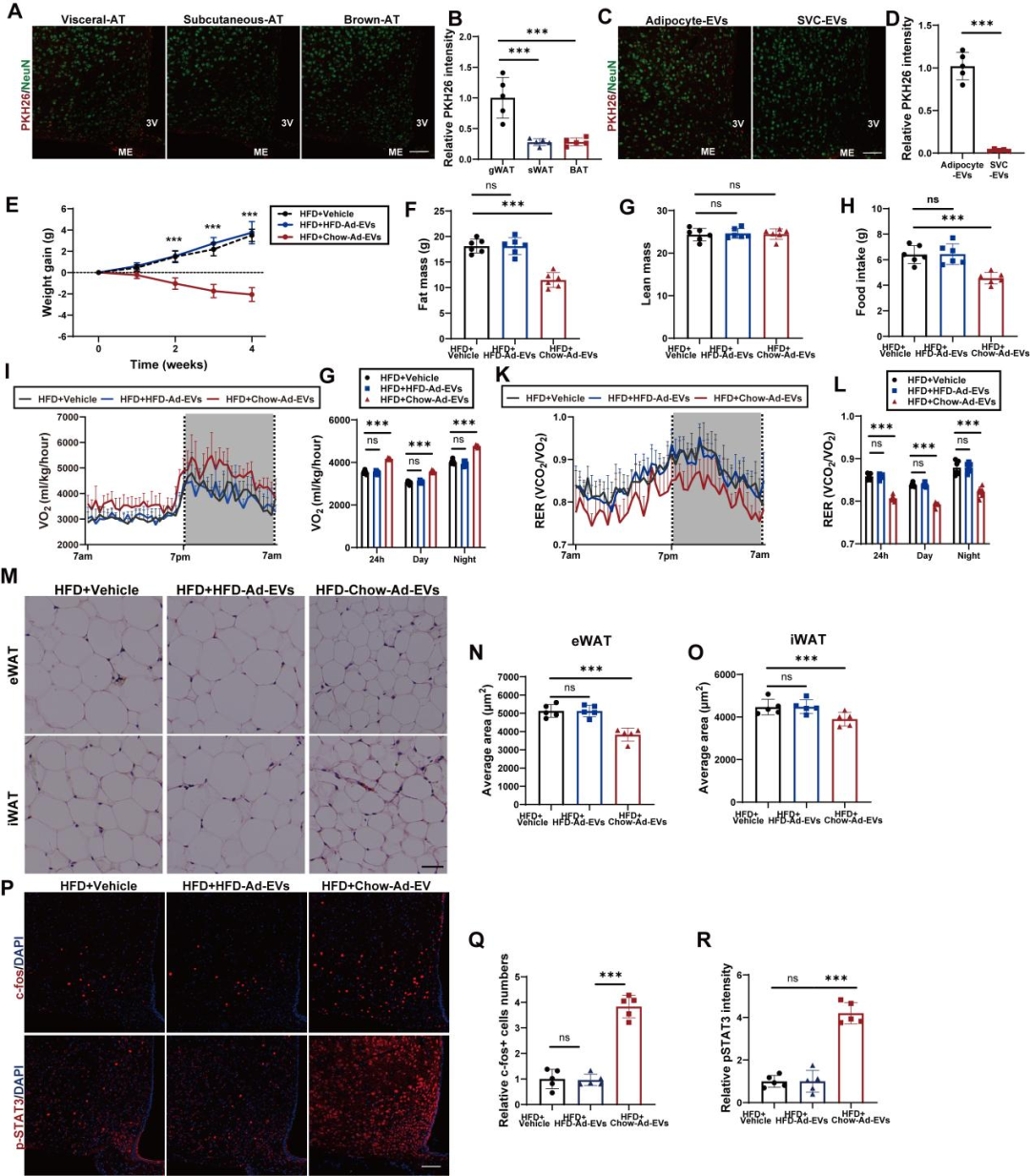 IF=30.9【客户文章—脂肪-脑轴】南京大学毕艳主任医师/李靓教授团队揭示Ad-EVs是中枢瘦素敏感性和能量稳态的关键调控因子