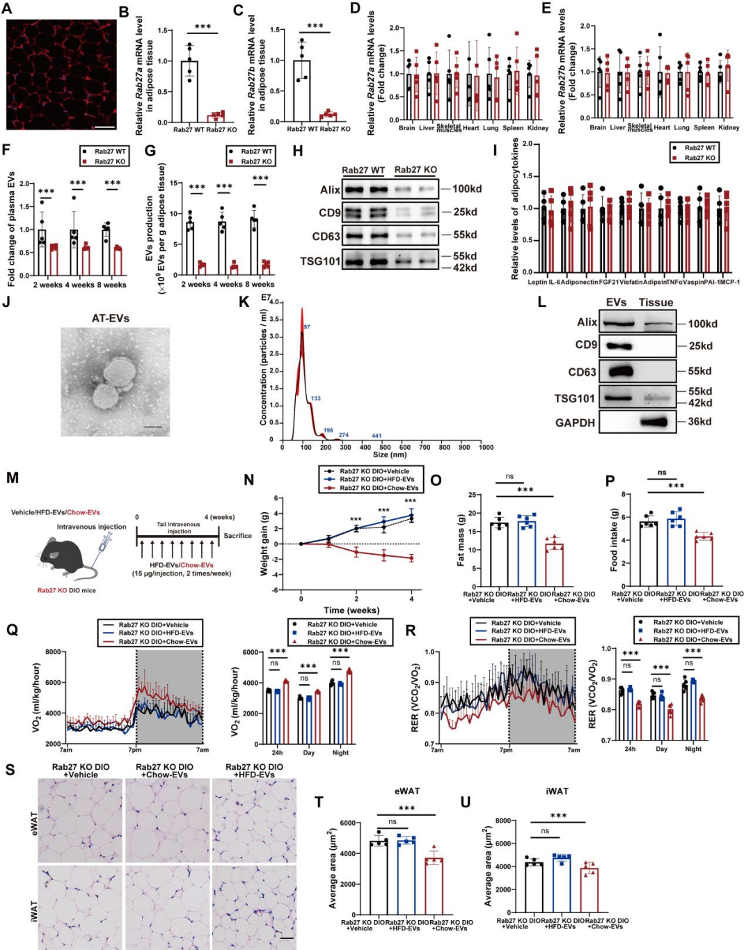 IF=30.9【客户文章—脂肪-脑轴】南京大学毕艳主任医师/李靓教授团队揭示Ad-EVs是中枢瘦素敏感性和能量稳态的关键调控因子