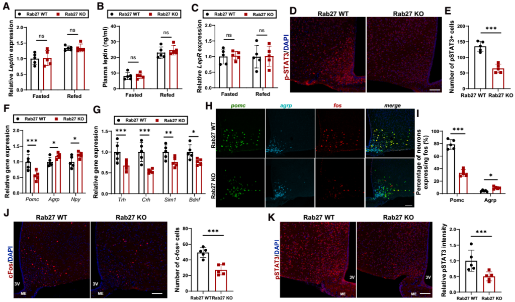 IF=30.9【客户文章—脂肪-脑轴】南京大学毕艳主任医师/李靓教授团队揭示Ad-EVs是中枢瘦素敏感性和能量稳态的关键调控因子