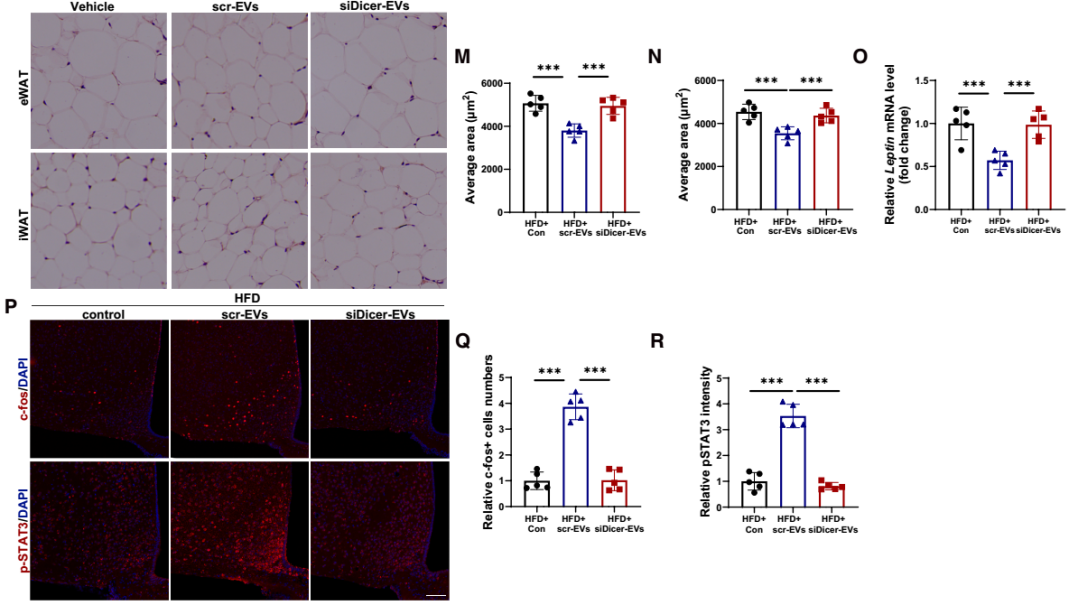 IF=30.9【客户文章—脂肪-脑轴】南京大学毕艳主任医师/李靓教授团队揭示Ad-EVs是中枢瘦素敏感性和能量稳态的关键调控因子