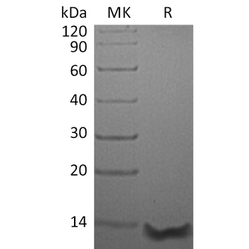 Human ACVR1C Protein蛋白, hFc Ta