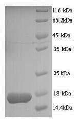 Yeast MDR1 Protein蛋白，orb246715