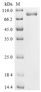 重组蛋白 Human Cadherin-10 (CDH10)