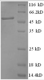 Human ANAPC5 Protein蛋白，orb2452