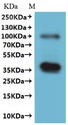 重组蛋白 Human Membrane Protein蛋白 