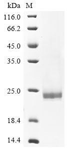 Hepatitis B virus genotype A2 