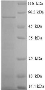E.coli p46 Protein蛋白，orb244656