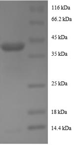 Human AROS Protein蛋白，orb245043