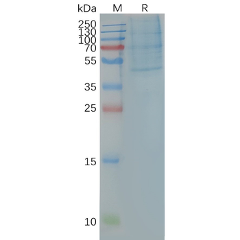 Human CCR4 full length Protein