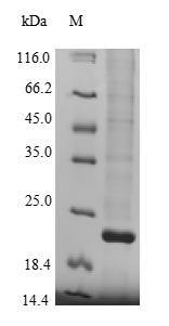 Human KDM5A Protein蛋白，orb24589