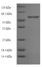 E.coli MDR1 Protein蛋白，orb24624
