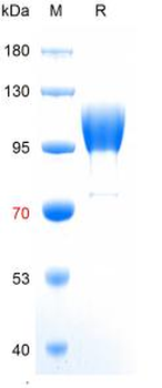 重组蛋白 human ACE2 Protein蛋白, His