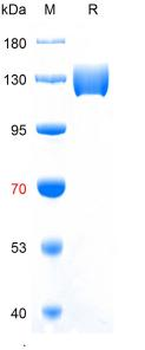 重组蛋白 human ACE2 Protein蛋白, hFc