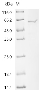 重组蛋白 Orientia tsutsugamushi 56