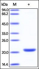 Human SMAC Protein蛋白, His Tag,