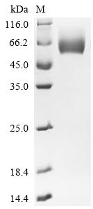 重组蛋白 Human Dipeptidase 2 (DPEP