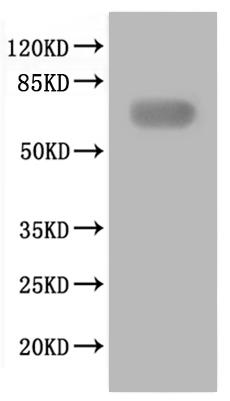 重组蛋白 Coxiella burnetii Replica