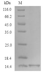 Xenopus TGFB1 Protein蛋白，orb358