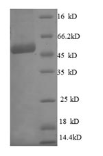 Human C21orf33 Protein蛋白，orb24