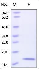 Human Reg4 Protein蛋白, His Tag，