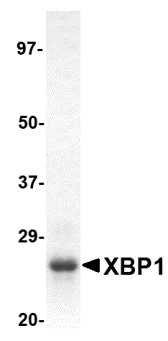 XBP1 重组蛋白，orb1228219，biorbyt